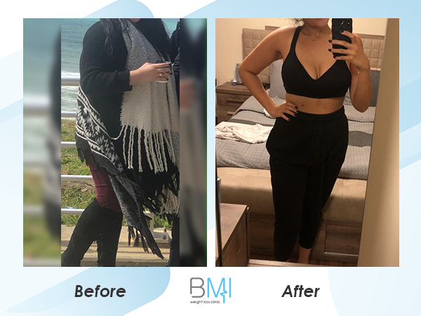 Weight Loss Surgery Before And After Advanced Bmi Lebanon Dr Nagi Jean Safa Clinic 2132